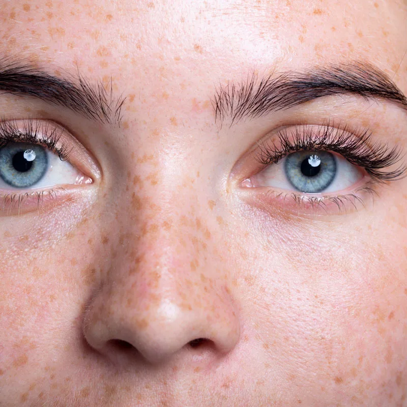 eyes